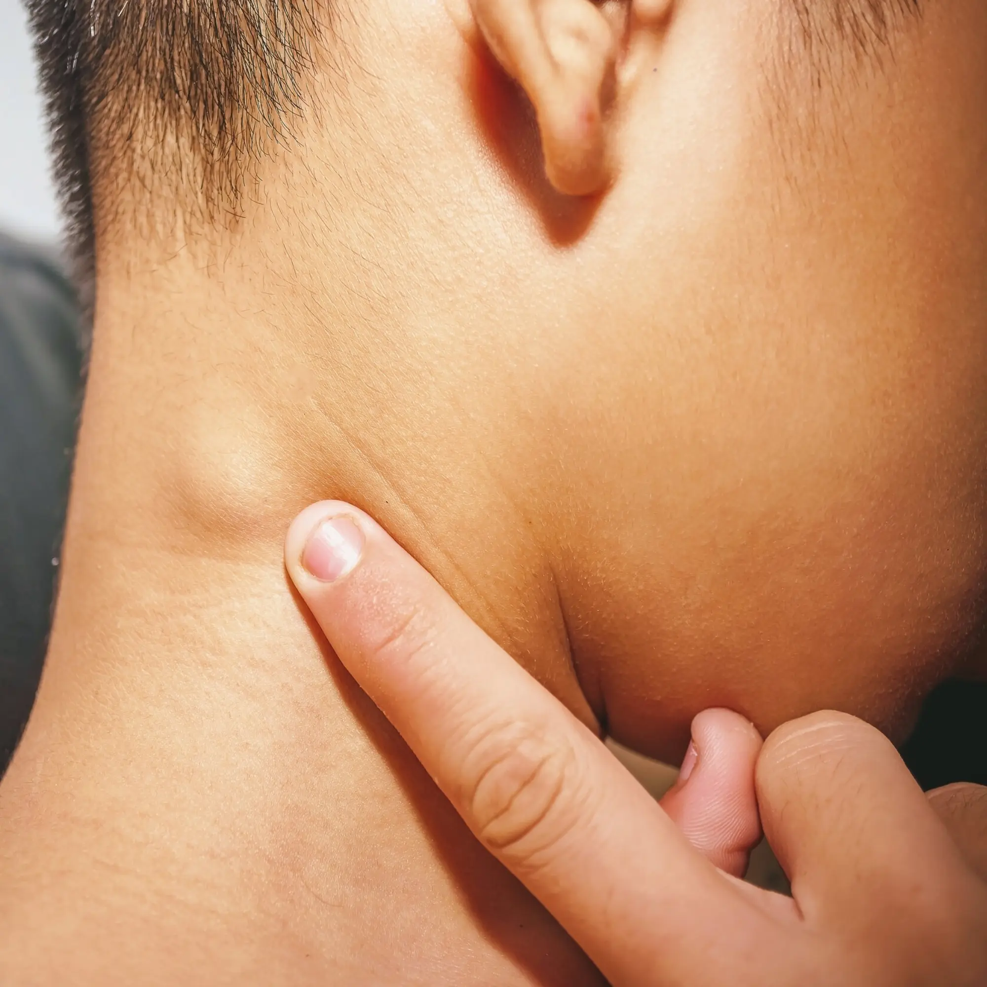 and Neck Cancers & Tumors